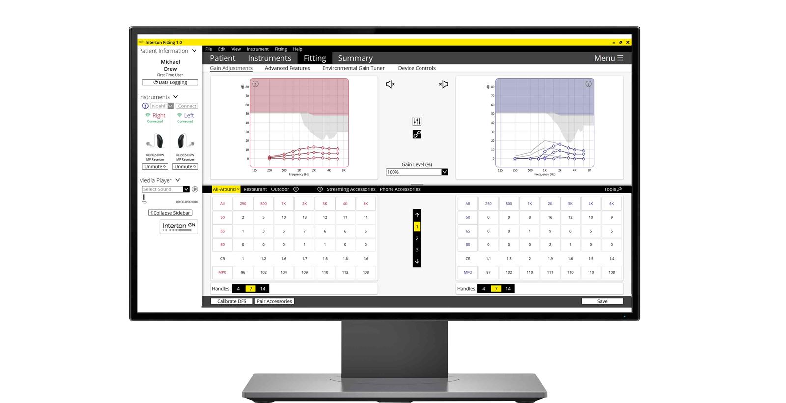 Hearing aid fitting: Now offering three input levels. Giving hearing care professionals more options for their fine-tuning process.